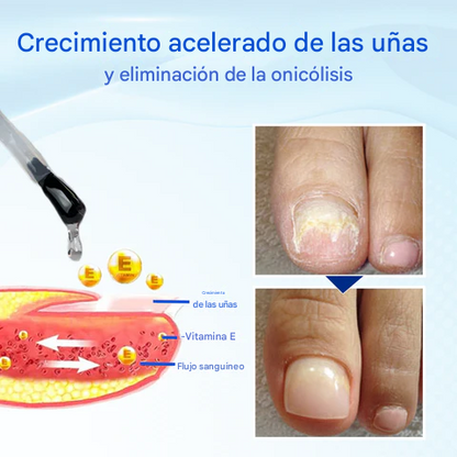 OnyxoGuard Suero para el crecimiento y la reparación de uñas