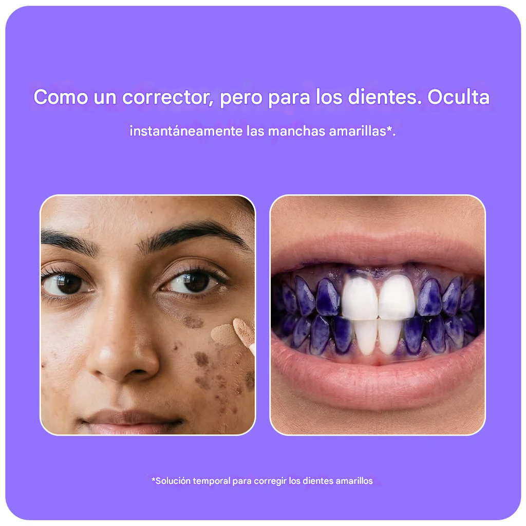 PERFORA® (30 ml) - ✨🦷 Solución blanqueadora dental instatanea