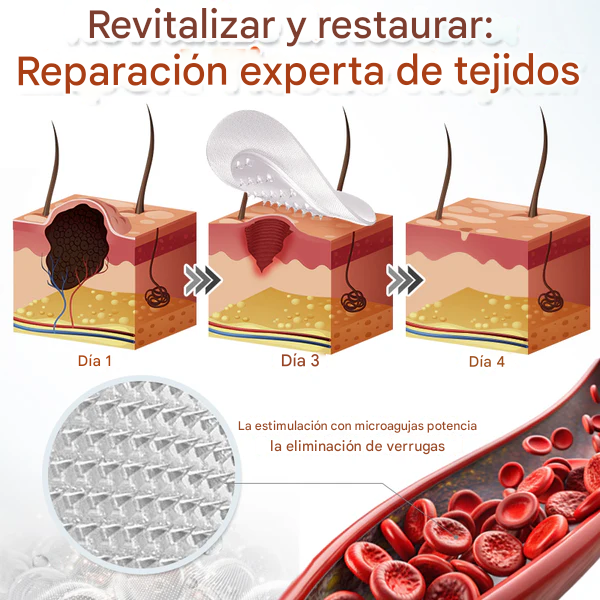 SkinPrik™ – Parche Botánico Anti-Verrugas (9 UND)