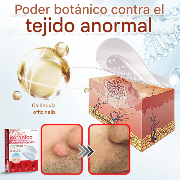 SkinPrik™ – Parche Botánico Anti-Verrugas (9 UND)