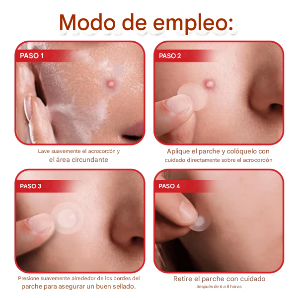 SkinPrik™ – Parche Botánico Anti-Verrugas (9 UND)