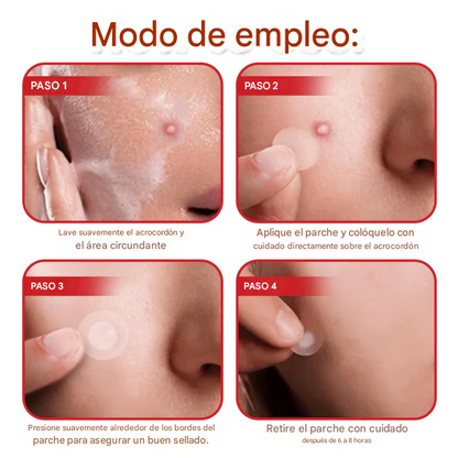 SkinPrik™ – Parche Botánico Anti-Verrugas (9 UND)