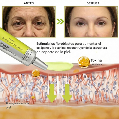 Celestvéra Obtenga un estiramiento facial al nivel del Botox sin agujas