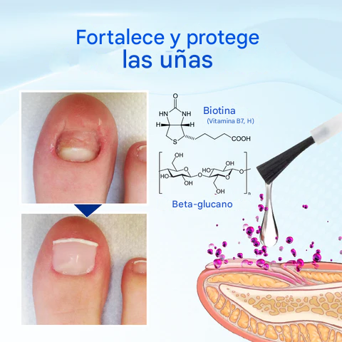 OnyxoGuard Suero para el crecimiento y la reparación de uñas