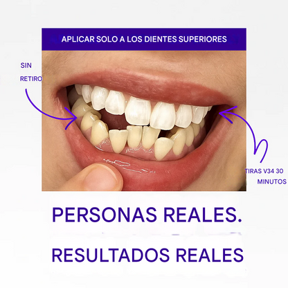 🔥Último día con 50% de descuento —— Parches blanqueadores V34