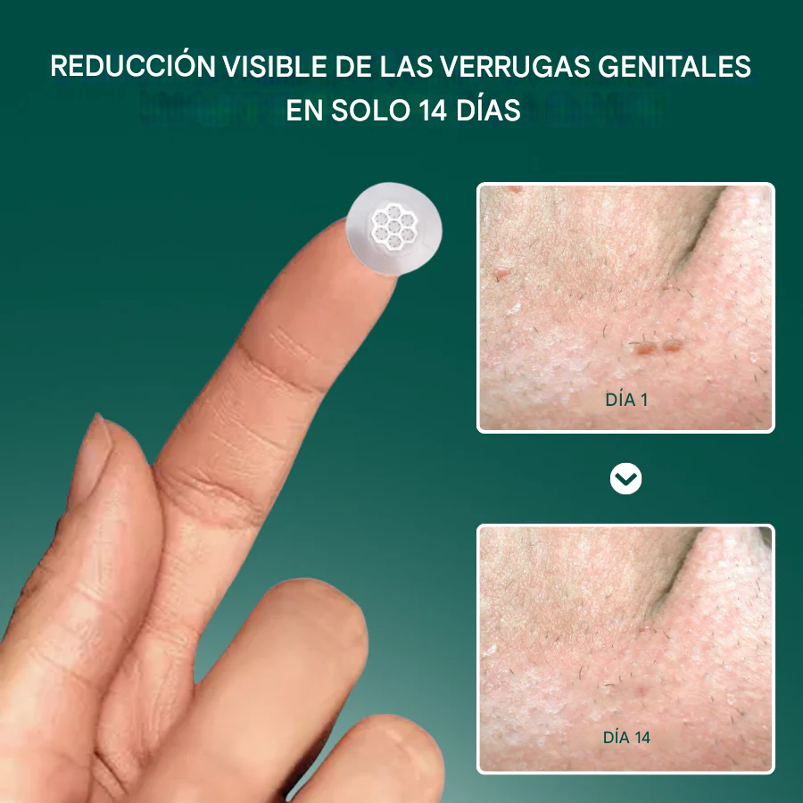 VeraClear fivfivgo™ – Solución Avanzada para Verrugas Genitales