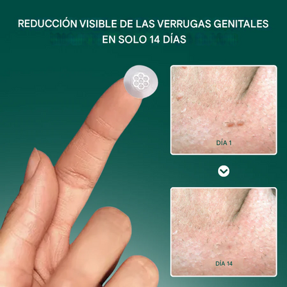 VeraClear fivfivgo™ – Solución Avanzada para Verrugas Genitales