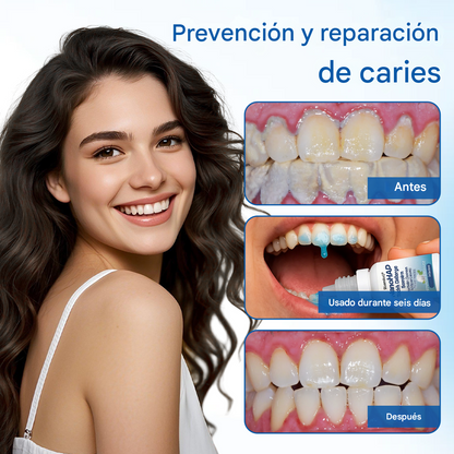 Suero protector dental Biancat® NanoHAP