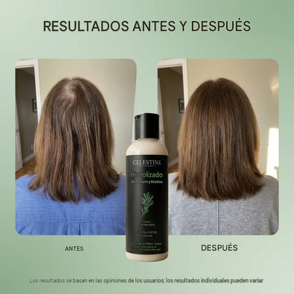Celestine - Shampoo De Romero Y Queratina