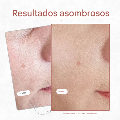 Prebase difuminadora de líneas de expresión CocoBeauty Precision Line Blur Primer