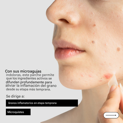 Parches de microagujas para detener las manchas
