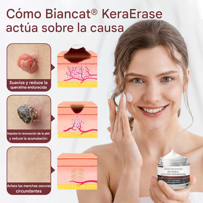KIT Biancat® KeraErase (2X1🔥🎁) 🧴Crema removedora de impurezas💆🏼‍♀️