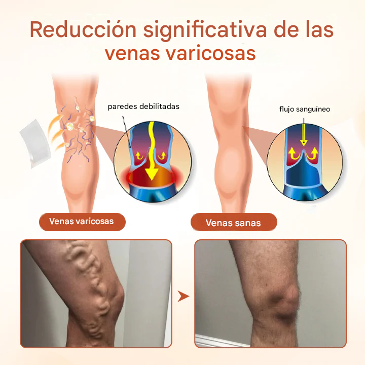 VeinTarget Parche Microagujas Venas Varices (10 PCS🔥🎁)