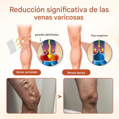 VeinTarget Parche Microagujas Venas Varices (10 PCS🔥🎁)